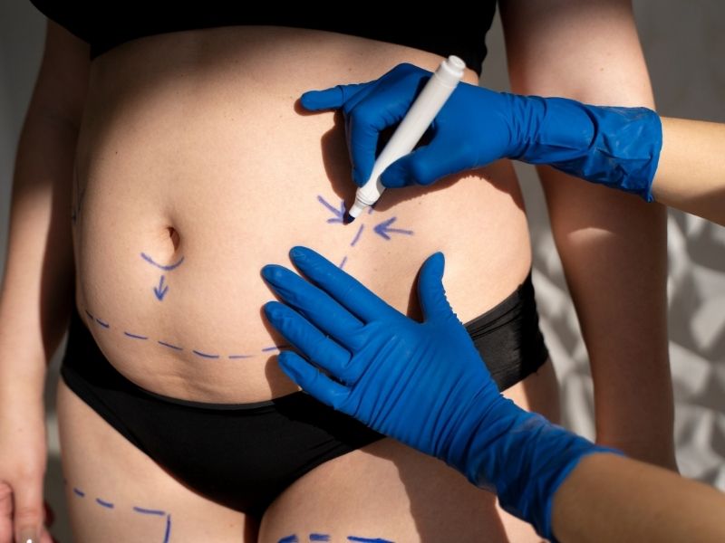 karin-germe-ameliyati-oncesi-dikkat-edilmesi-gerekenler