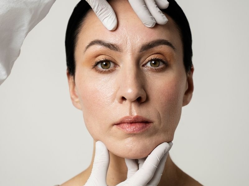 yuz-kiriklari-tedavisi